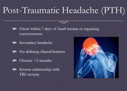 Diagnose Headache Types From Headache Chart Dosplash Diagnose Headache Types From Headache Chart Dosplash