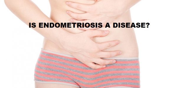 DIAGNOSIS Is Endometriosis a disease?