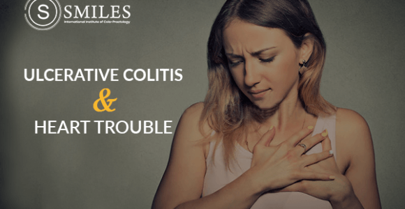 Ulcerative Colitis tied to higher risk of Heart Trouble – SMILES Bangalore