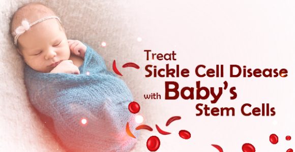 Treatment for Sickle Cell Has Found a Destination With Baby Stem Cells