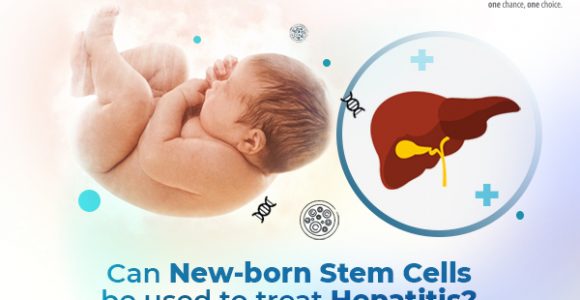 Can New-born Stem Cells Be Used to Treat Hepatitis?