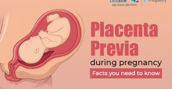 Placenta Previa During Pregnancy: Facts You Need To Know