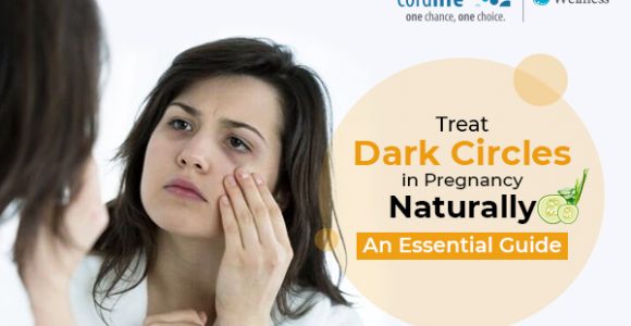 Guide To Treat Dark Circles During Pregnancy Naturally